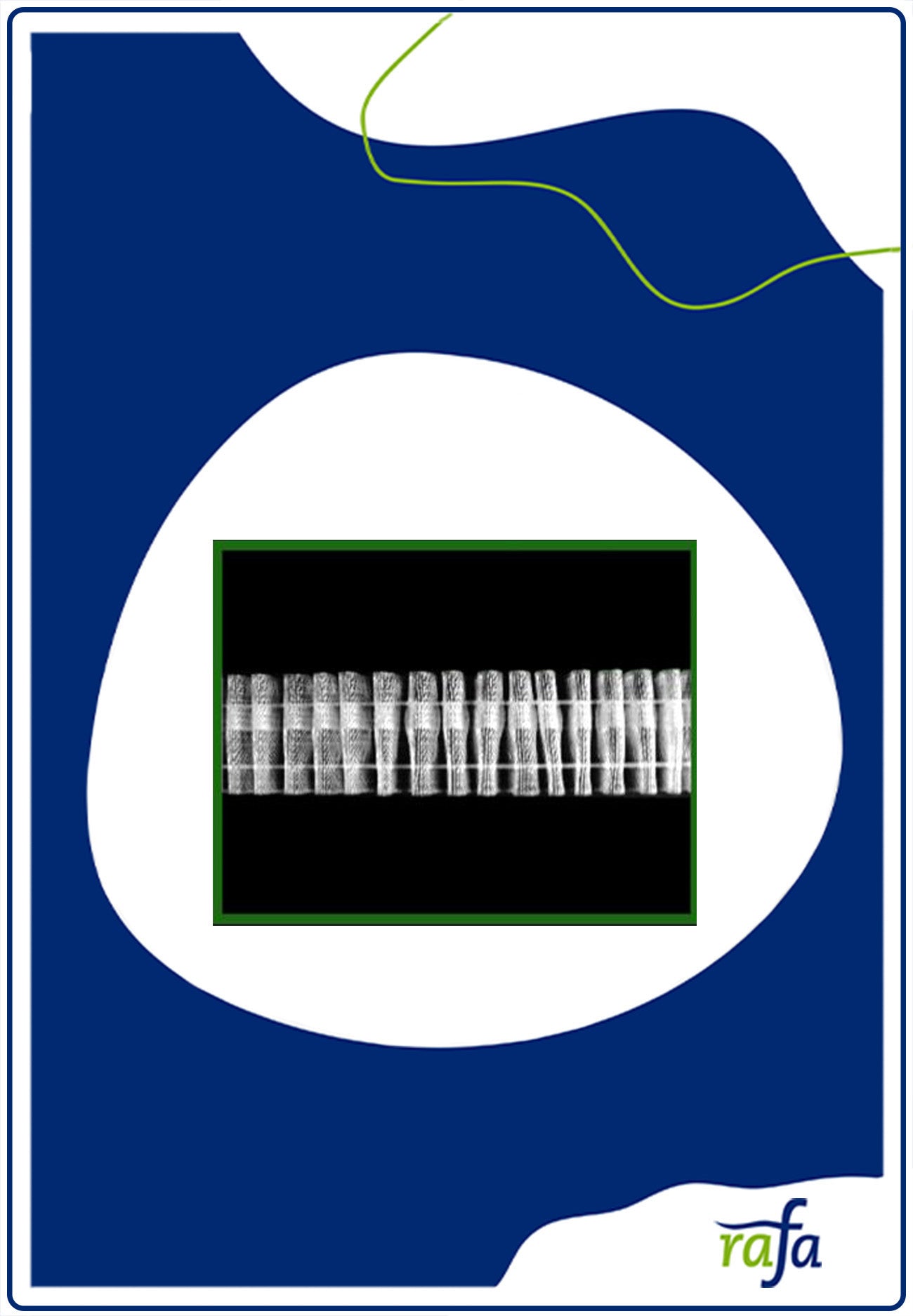 Falte an Falte Band 30mm transparent